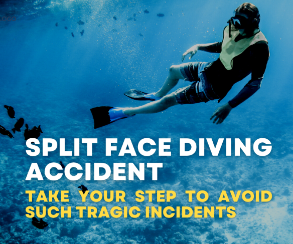 split face diving accidents