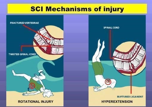 split face driving accidents
